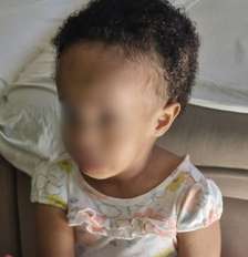 Zoe Santos Cardoso precisa fazer uma cirurgia urgente para diminuir a pressão craniana provocada por um condição rara Foto: Arquivo pessoal