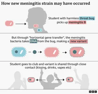 Cientistas descobrem por que a epidemia de meningite em Kent foi tão grave