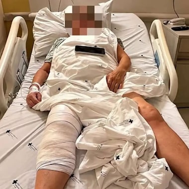 Mulher acorda após cirurgia no Paraná e percebe que médico implantou prótese no joelho errado