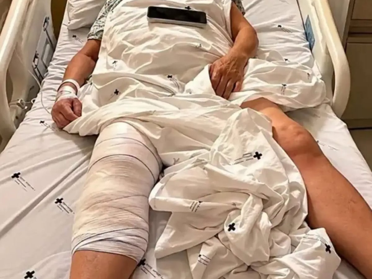Mulher acorda após cirurgia no Paraná e percebe que médico implantou prótese no joelho errado