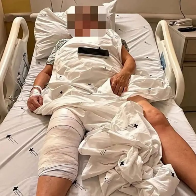 Mulher acorda após cirurgia no Paraná e percebe que médico implantou prótese no joelho errado